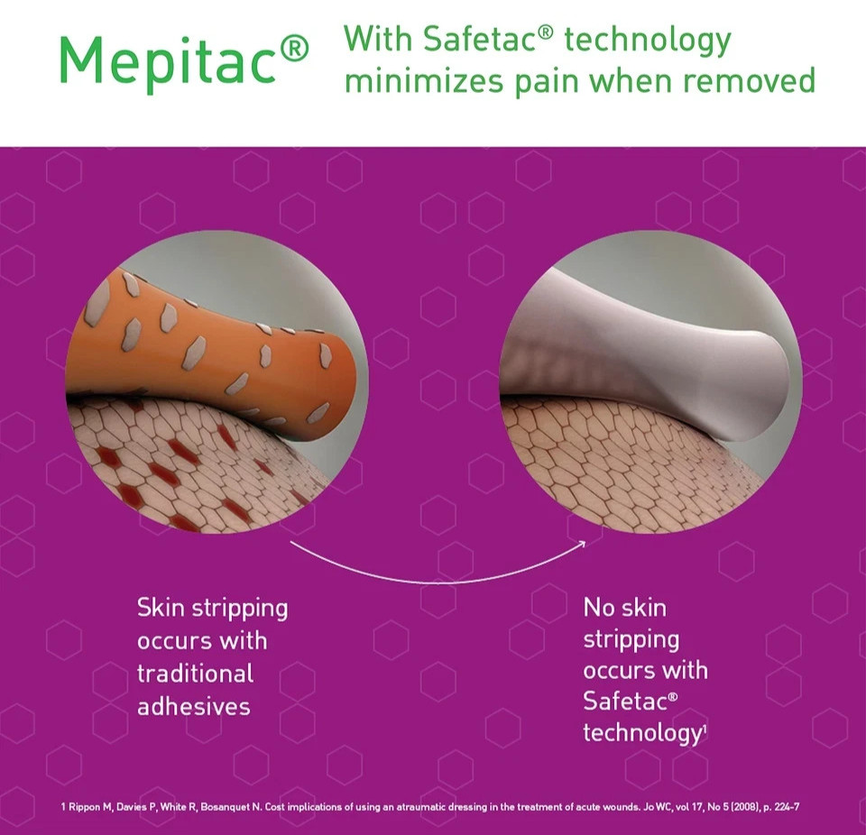 Molnlycke Mepitac Soft Silicone Tape, 0.8″ x 3.3 Yards – Damaged box