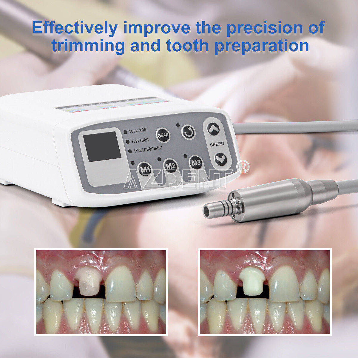 AZDENT Dental LED Brushless Electric Micro Motor/1:1/1:5/1:4.2 LED Handpiece
