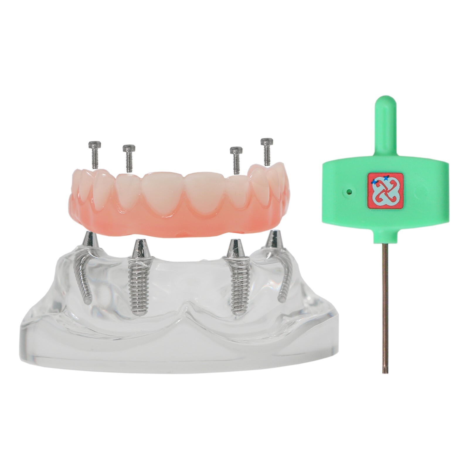 All-on-4/6 Screws Restoration Overdenture Dental Implant Model Upper/Lower Jaw